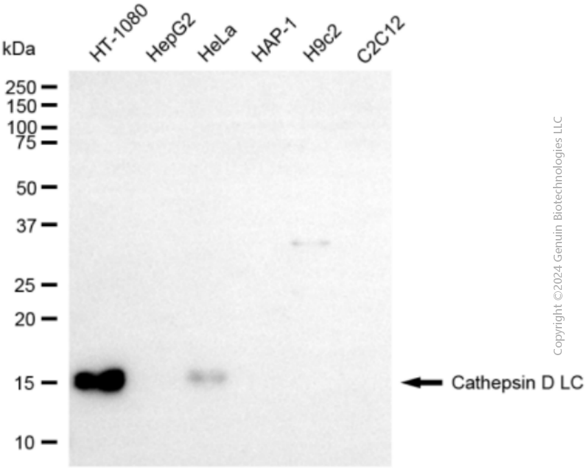 KD-Validated Anti-Cathepsin D LC Rabbit Polyclonal Antibody ABG2120