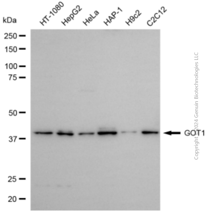 KD-Validated Anti-GOT1 Rabbit Polyclonal Antibody ABG2121