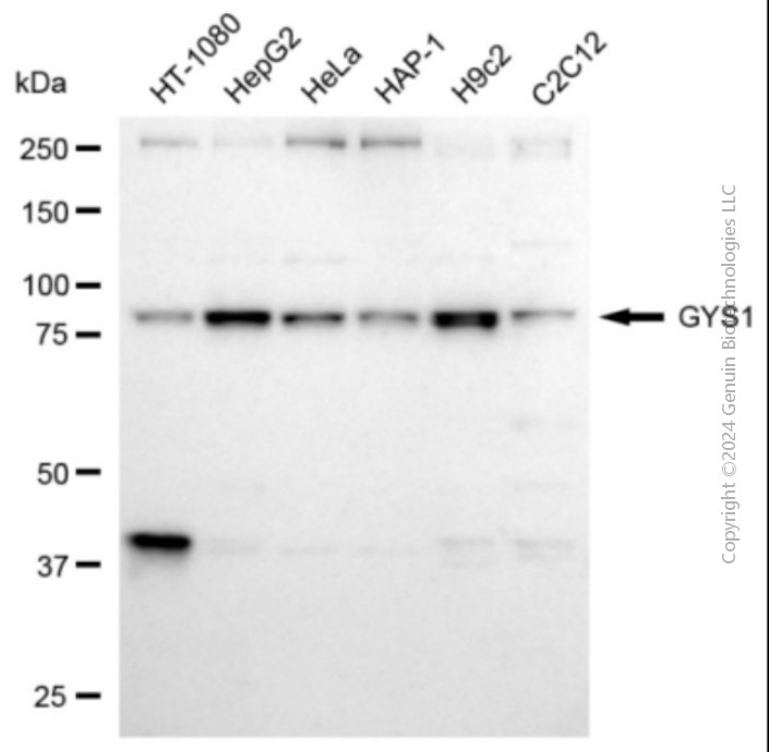 KD-Validated Anti-GYS1 Rabbit Polyclonal Antibody ABG2122