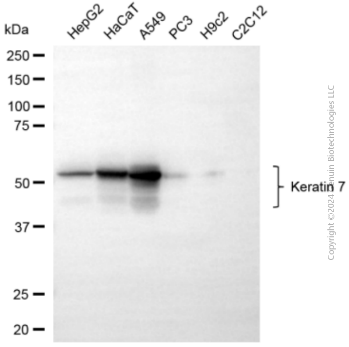 KD-Validated Anti-KeRatin 7 Rabbit Polyclonal Antibody ABG2124