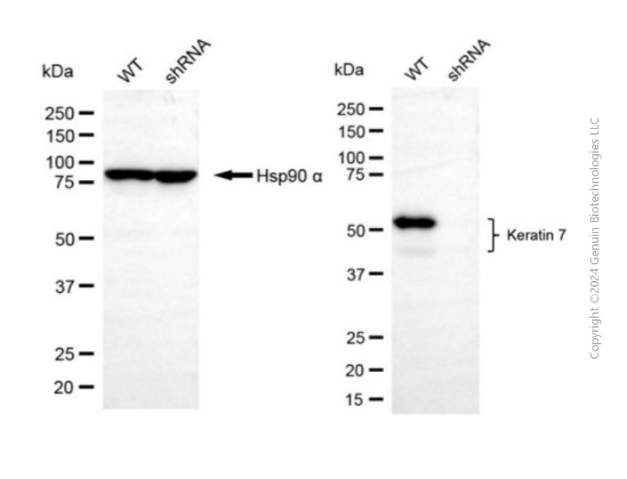 KD-Validated Anti-KeRatin 7 Rabbit Polyclonal Antibody ABG2124