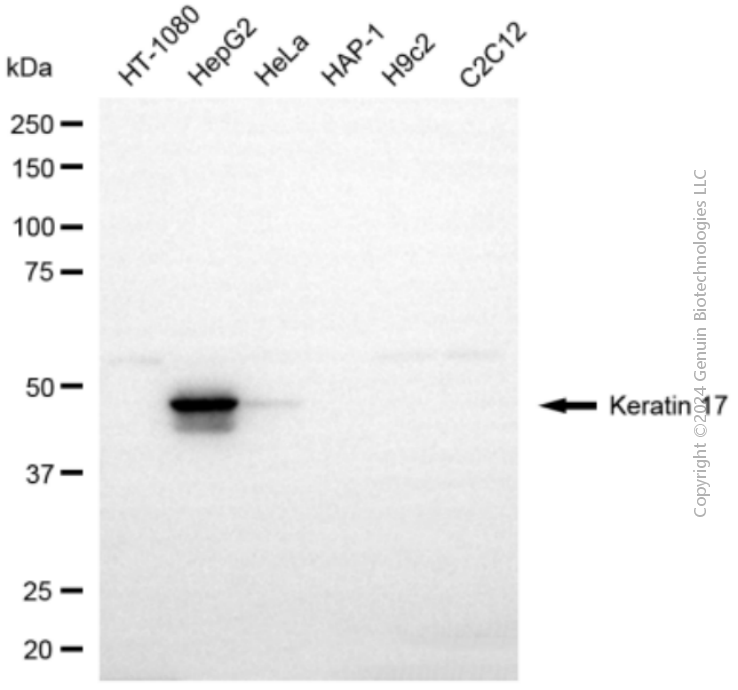 KD-Validated Anti-KeRatin 17 Rabbit Polyclonal Antibody ABG2125