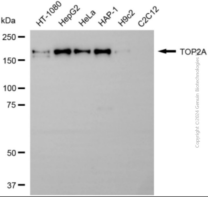 KD-Validated Anti-TOP2A Rabbit Polyclonal Antibody ABG2132