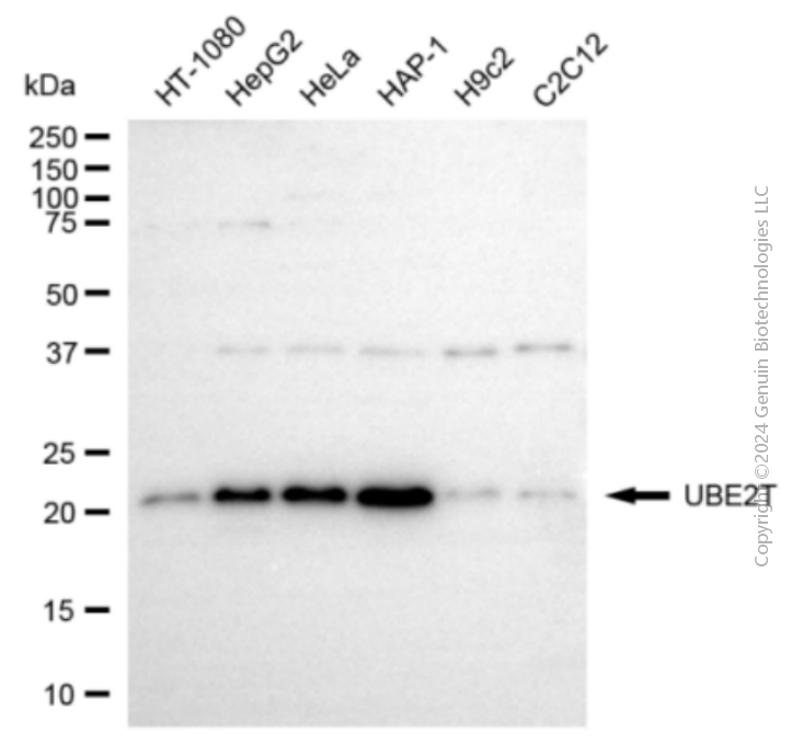 KD-Validated Anti-UBE2T Rabbit Polyclonal Antibody ABG2139
