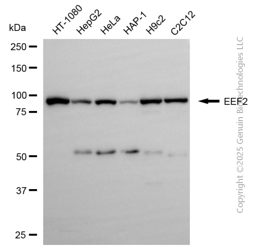 KD-Validated Anti-EEF2 Rabbit Polyclonal Antibody ABG2145