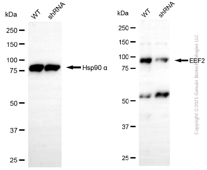 KD-Validated Anti-EEF2 Rabbit Polyclonal Antibody ABG2145