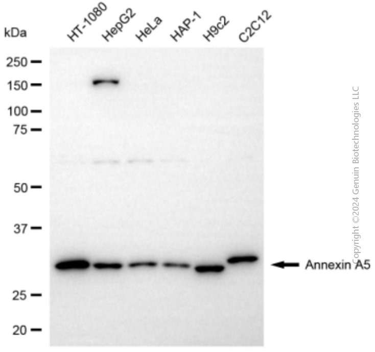 KD-Validated Anti-Annexin A5 Rabbit Polyclonal Antibody ABG2148