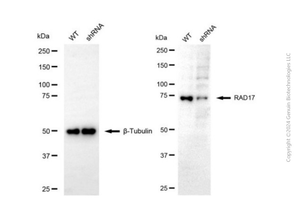 KD-Validated Anti-RAD17 Rabbit Polyclonal Antibody ABG2150