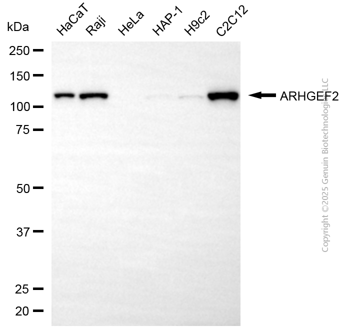KD-Validated Anti-ARHGEF2 Rabbit Polyclonal Antibody ABG2152