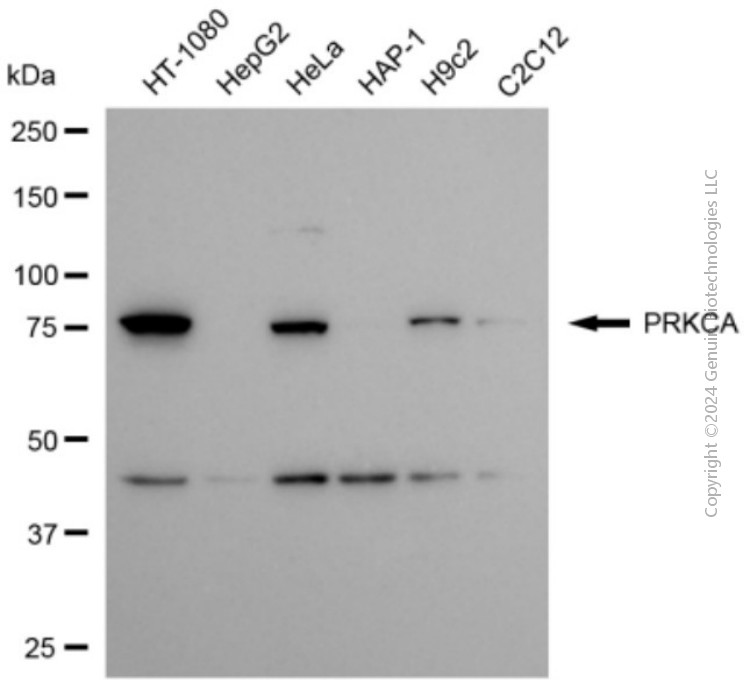 KD-Validated Anti-PRKCA Rabbit Polyclonal Antibody ABG2154