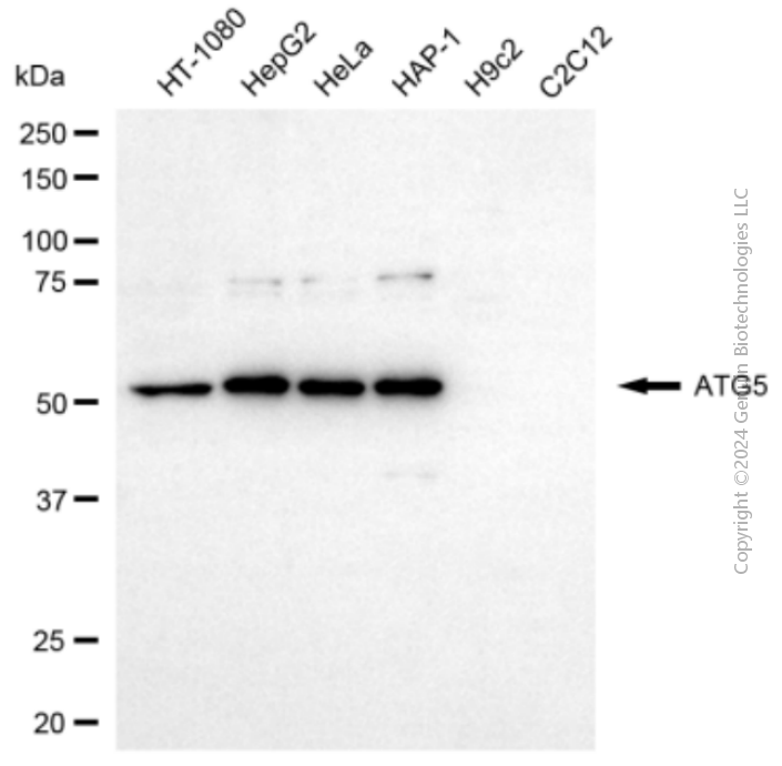 KD-Validated Anti-ATG5 Rabbit Polyclonal Antibody ABG2155