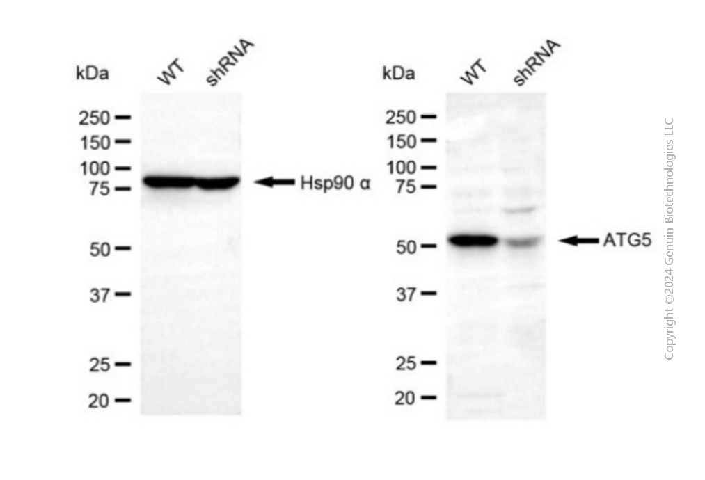 KD-Validated Anti-ATG5 Rabbit Polyclonal Antibody ABG2155