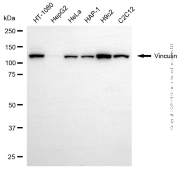 KD-Validated Anti-Vinculin Rabbit Polyclonal Antibody ABG2157