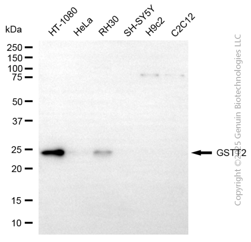 KD-Validated Anti-GSTT2 Mouse Monoclonal Antibody ABG2159
