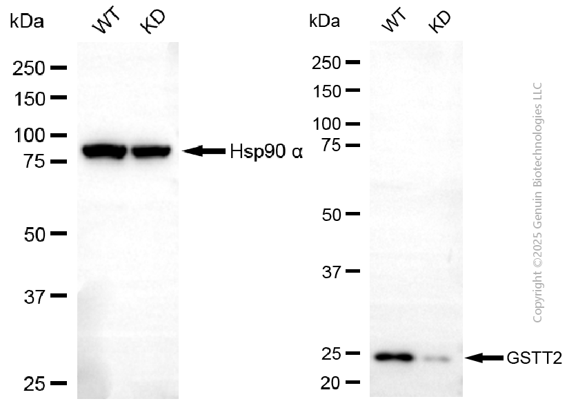 KD-Validated Anti-GSTT2 Mouse Monoclonal Antibody ABG2159