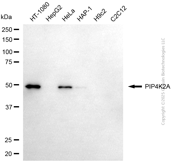 KD-Validated Anti-PIP4K2A Mouse Monoclonal Antibody ABG2161