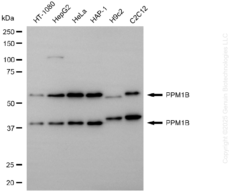 KD-Validated Anti-PPM1B Mouse Monoclonal Antibody ABG2164