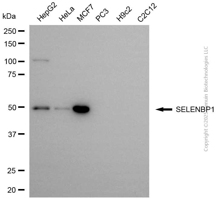 KD-Validated Anti-SELENBP1 Mouse Monoclonal Antibody ABG2167