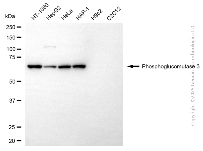 KD-Validated Anti-Phosphoglucomutase 3 Mouse Monoclonal Antibody ABG2168