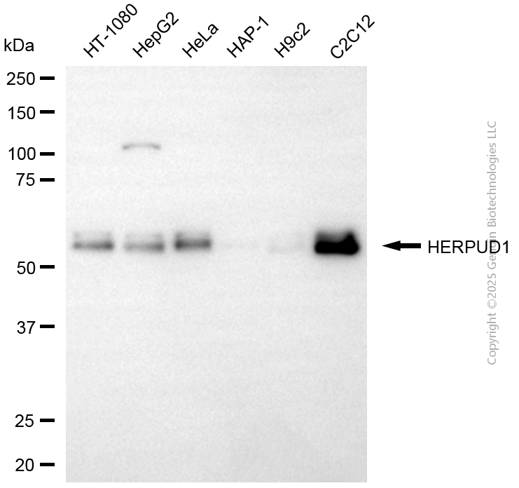 KD-Validated Anti-HERPUD1 Mouse Monoclonal Antibody ABG2169