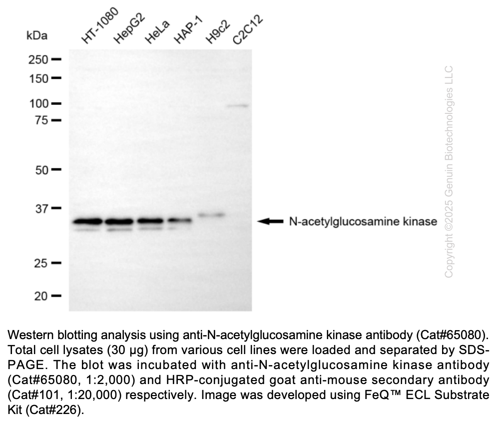 KD-Validated Anti-NAGK Mouse Monoclonal Antibody ABG2175