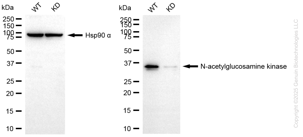 KD-Validated Anti-NAGK Mouse Monoclonal Antibody ABG2175