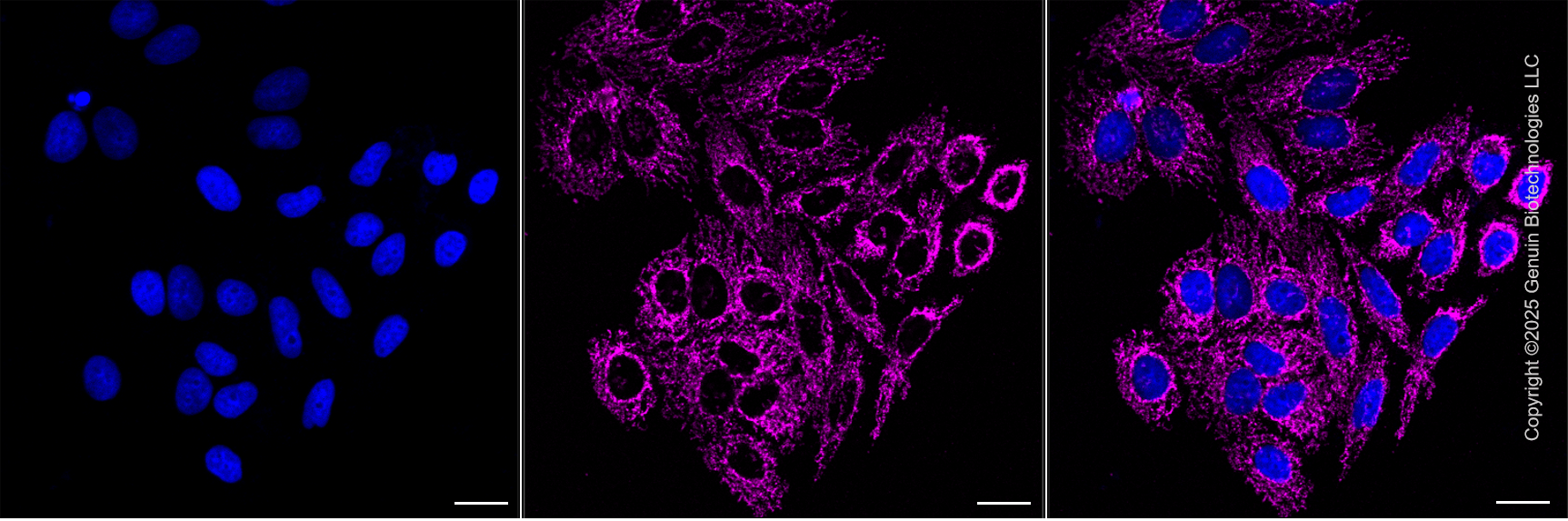 KD-Validated Anti-IMMT Mouse Monoclonal Antibody ABG2185