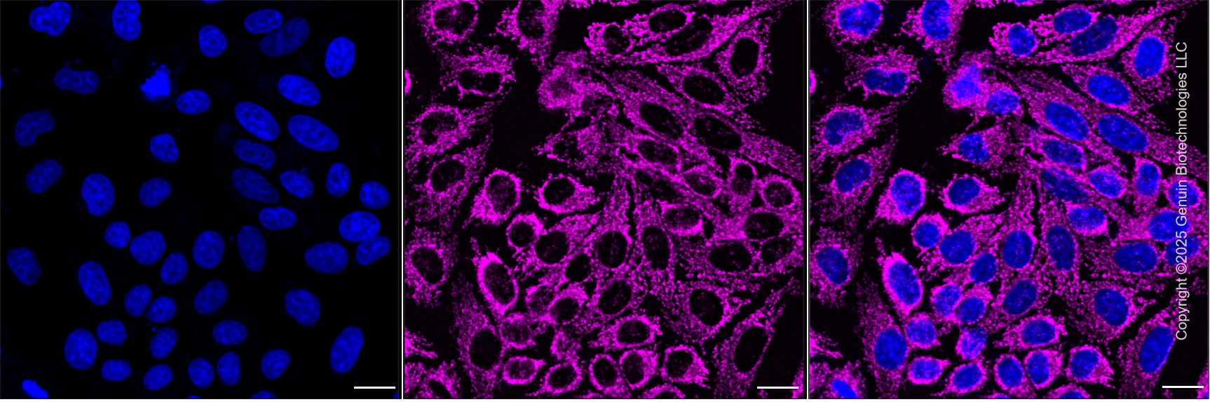 KD-Validated Anti-IMMT Mouse Monoclonal Antibody ABG2186