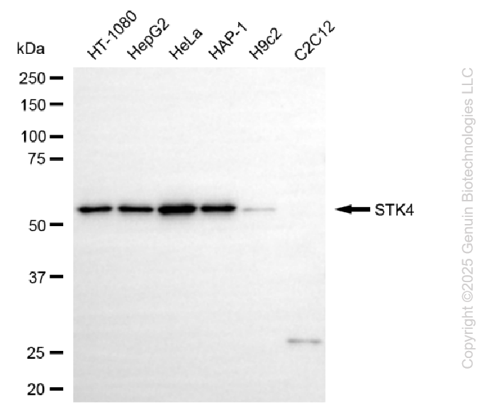 KD-Validated Anti-STK4 Rabbit Monoclonal Antibody ABG2195