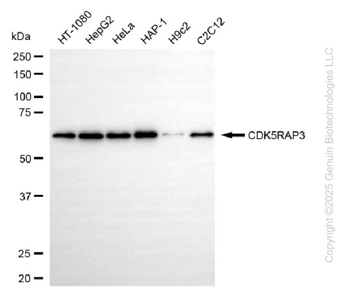 KD-Validated Anti-CDK5RAP3 Rabbit Monoclonal Antibody ABG2197