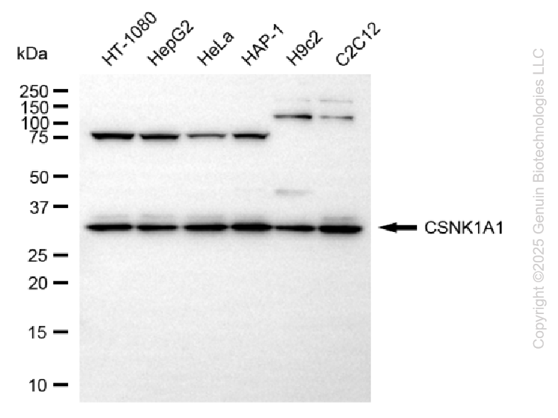 KD-Validated Anti-CSNK1A1 Rabbit Monoclonal Antibody ABG2198