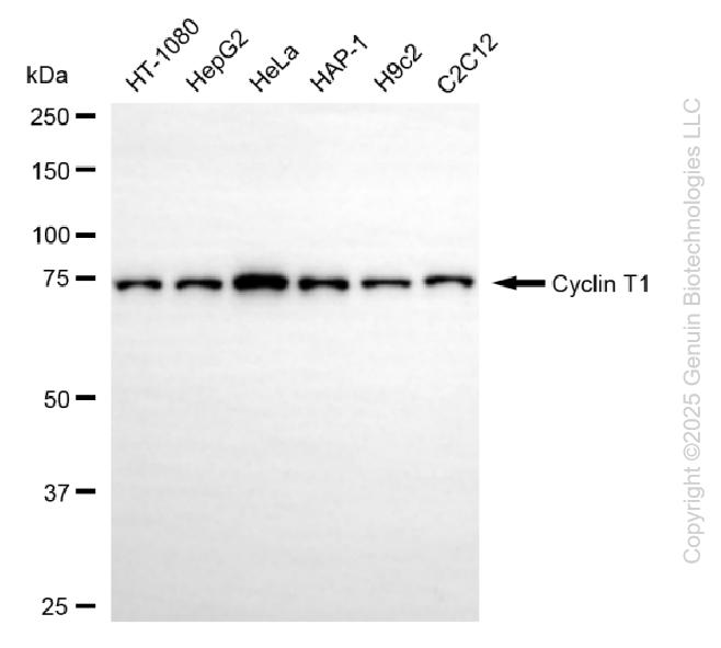 KD-Validated Anti-Cyclin T1 Rabbit Monoclonal Antibody ABG2202