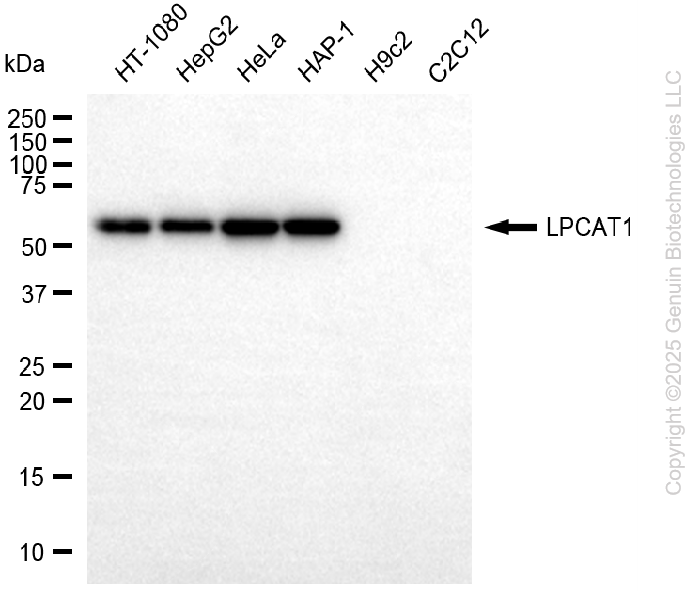 KD-Validated Anti-LPCAT1 Rabbit Monoclonal Antibody ABG2204