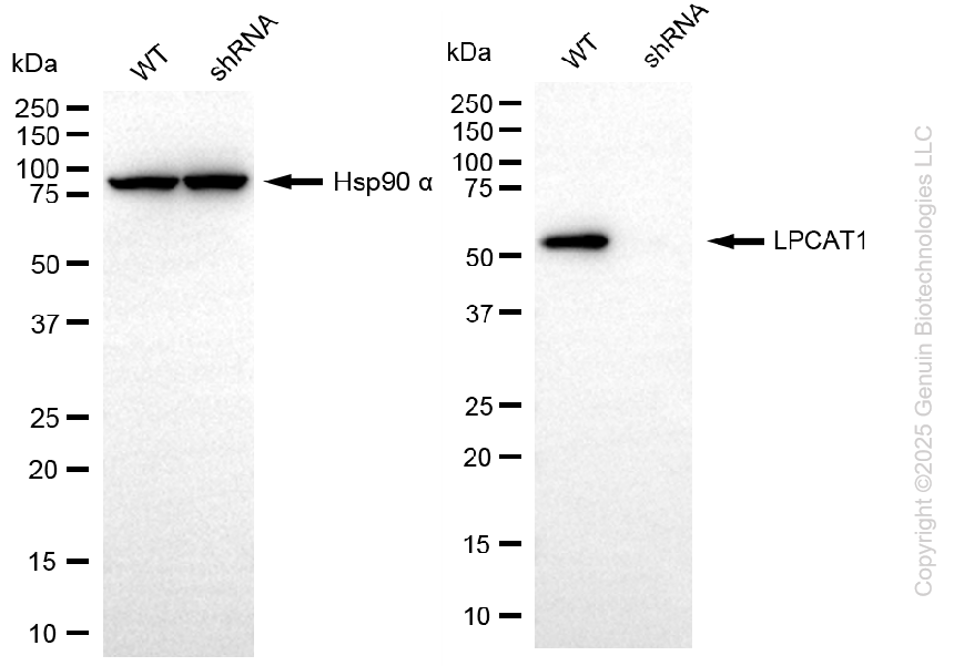 KD-Validated Anti-LPCAT1 Rabbit Monoclonal Antibody ABG2204