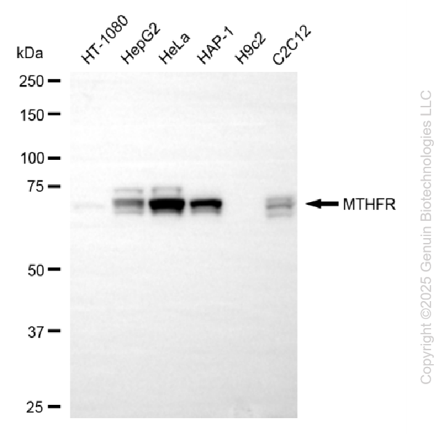 KD-Validated Anti-MTHFR Rabbit Monoclonal Antibody ABG2206
