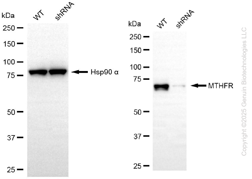 KD-Validated Anti-MTHFR Rabbit Monoclonal Antibody ABG2206