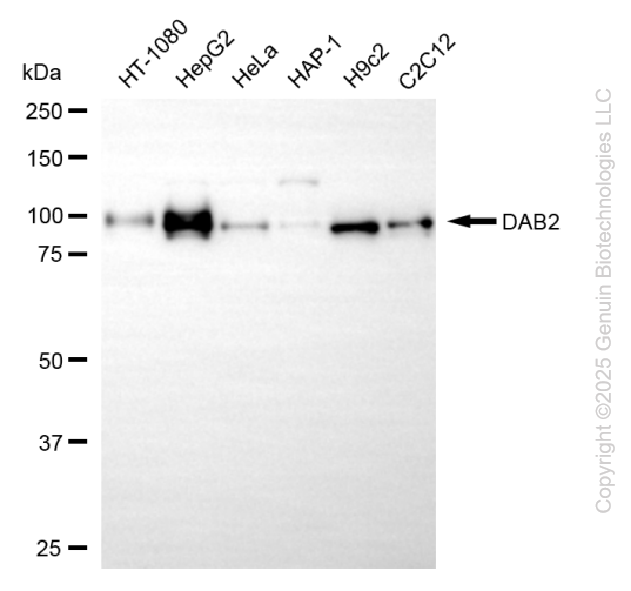 KD-Validated Anti-DAB2 Rabbit Monoclonal Antibody ABG2209