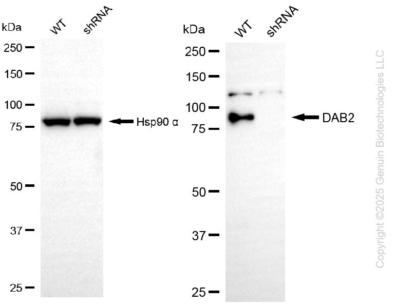KD-Validated Anti-DAB2 Rabbit Monoclonal Antibody ABG2209