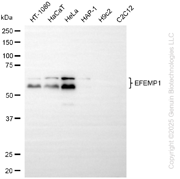 KD-Validated Anti-EFEMP1 Rabbit Monoclonal Antibody ABG2210