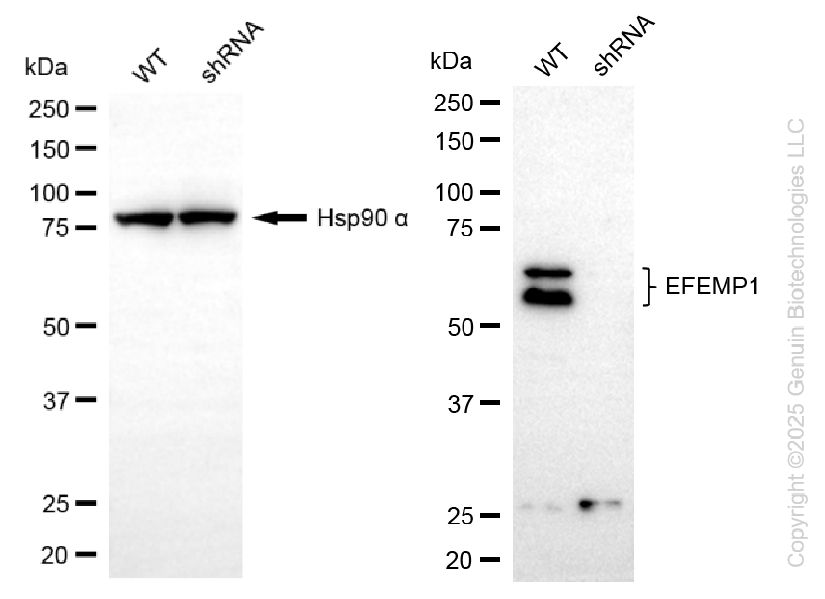 KD-Validated Anti-EFEMP1 Rabbit Monoclonal Antibody ABG2210