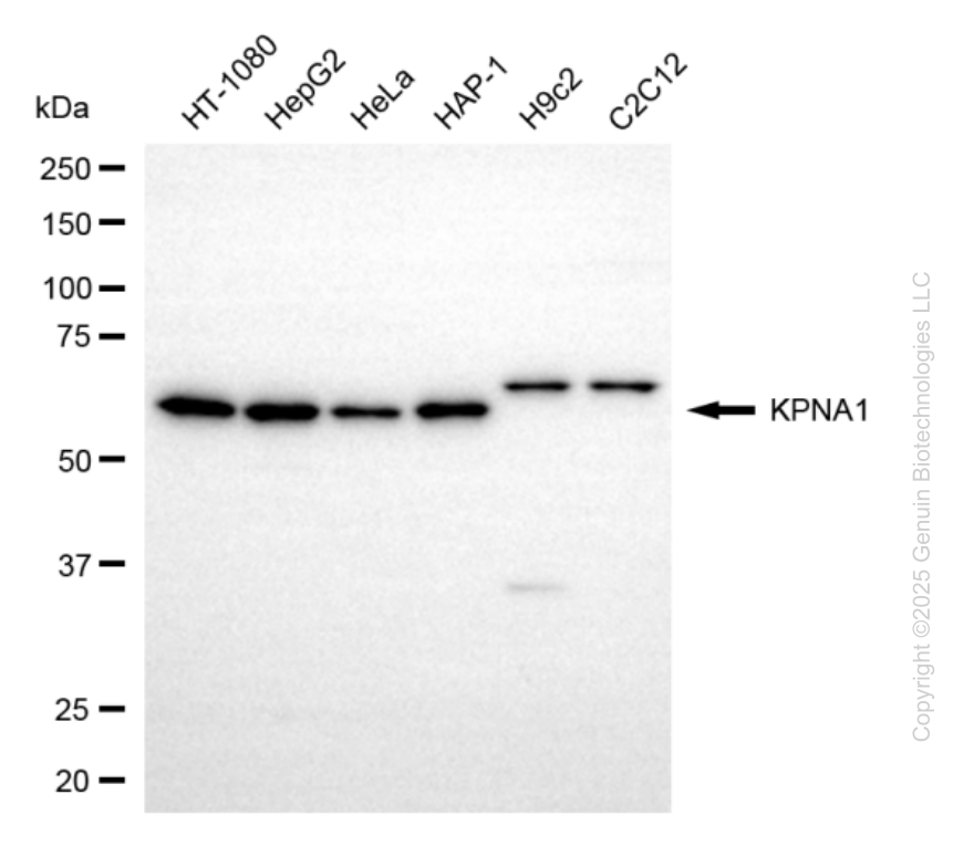KD-Validated Anti-KPNA1 Mouse Monoclonal Antibody ABG2223