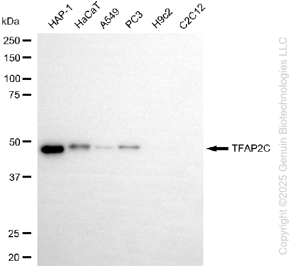 KD-Validated Anti-TFAP2C Rabbit Monoclonal Antibody ABG2229