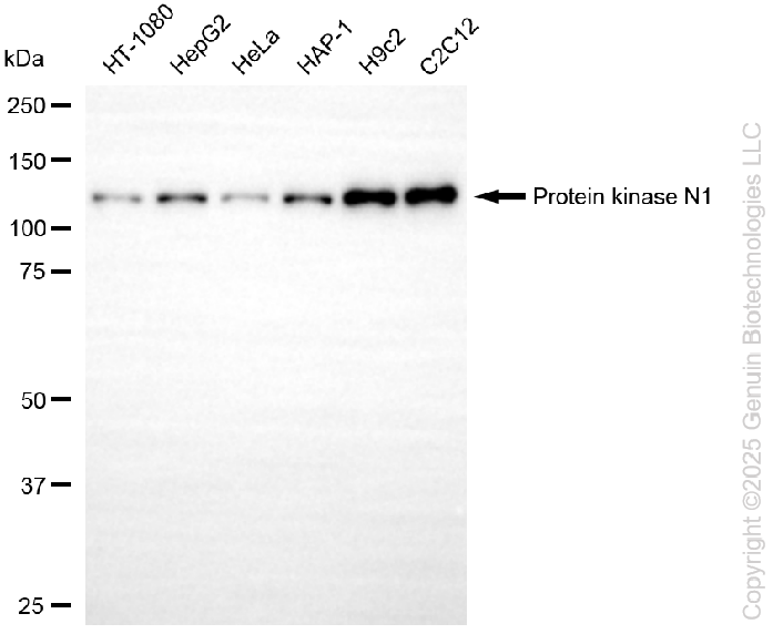 KD-Validated Anti-PKN1 Rabbit Monoclonal Antibody ABG2234