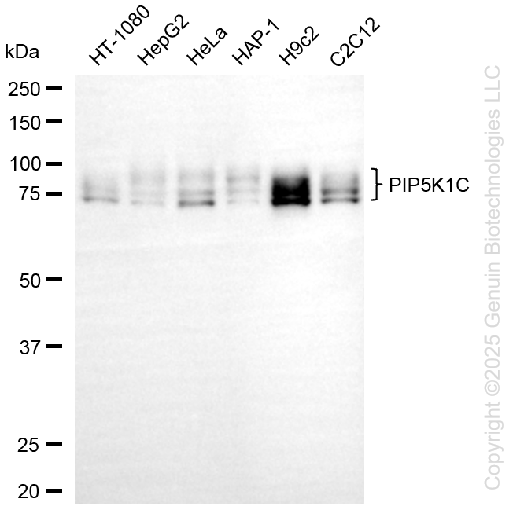 KD-Validated Anti-PIP5K1C Rabbit Monoclonal Antibody ABG2235