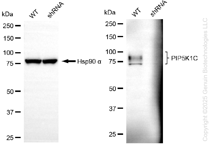 KD-Validated Anti-PIP5K1C Rabbit Monoclonal Antibody ABG2235
