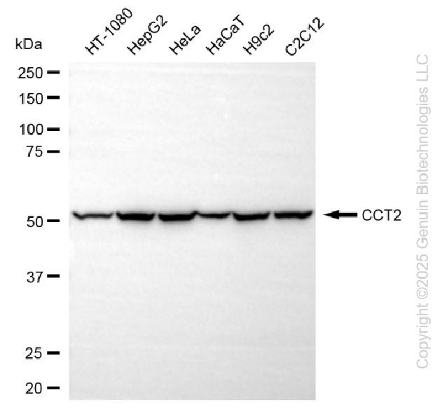 KD-Validated Anti-CCT2 beta Rabbit Monoclonal Antibody ABG2241