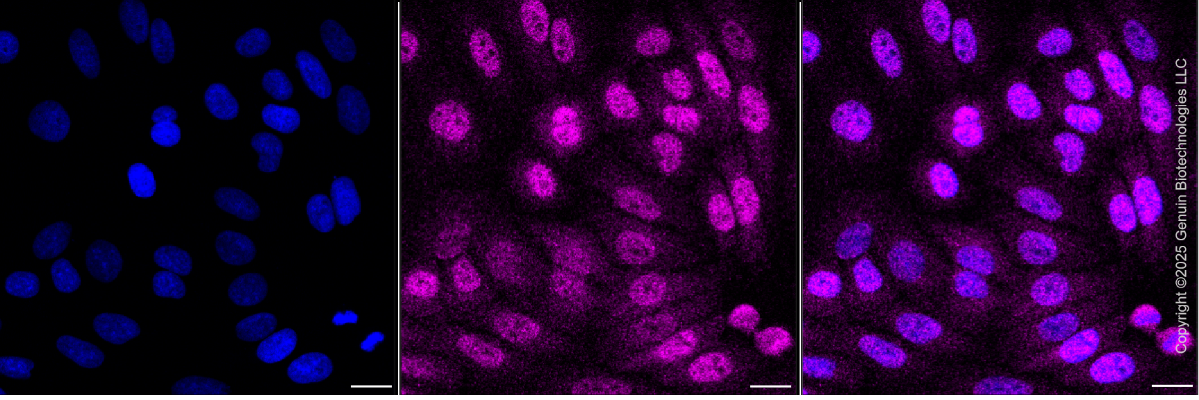 KD-Validated Anti-UCH L5 Rabbit Monoclonal Antibody ABG2242
