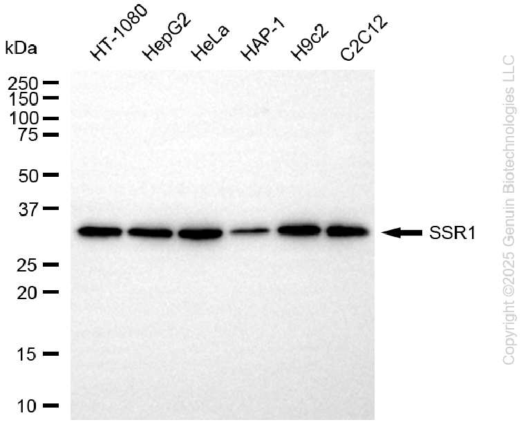 KD-Validated Anti-SSR1 Rabbit Monoclonal Antibody ABG2244