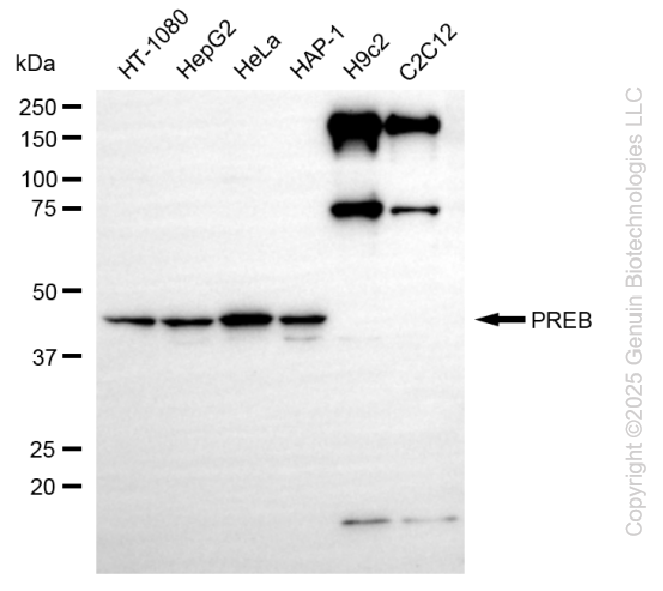KD-Validated Anti-PREB Rabbit Monoclonal Antibody ABG2247