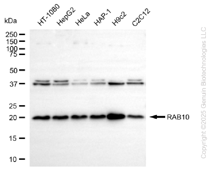 KD-Validated Anti-RAB10 Rabbit Monoclonal Antibody ABG2263